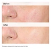 Picture of Alpha Arbutin 2% + HA  (30 ml)