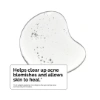 Picture of Salicylic Acid 2% Solution (30 ml)