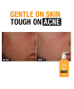 Picture of Neutrogena Oil Free Acne Wash (Fragrance Free) (269 ml)