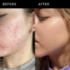 Picture of The Inkey List Niacinamide