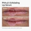 Picture of The Ordinary PHA 5% Exfoliating Lip Serum